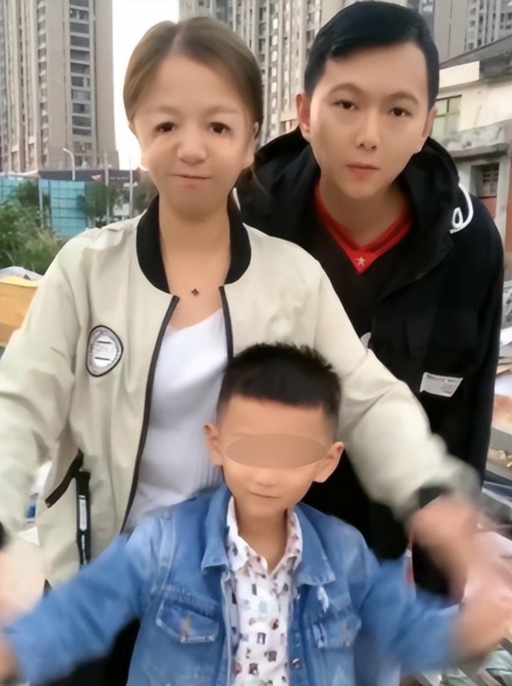 "鸟脸"妈妈不听劝阻拼二胎,现如今6岁儿子外貌遗传,智力受损
