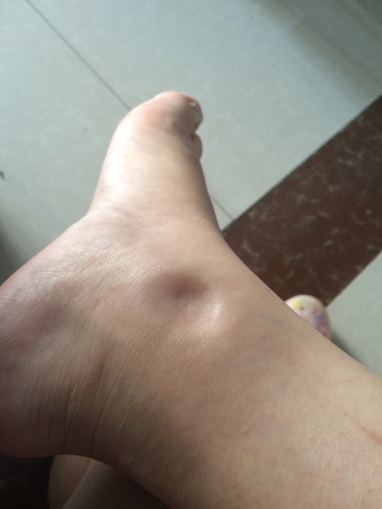 心脏好不好,看4个地方,坚持2个运动,牢记3个习惯,心越来越好