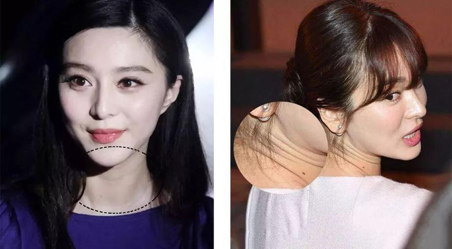 颈部有"三道纹"别不在意,后果难以想象,看着比实际年龄老十岁