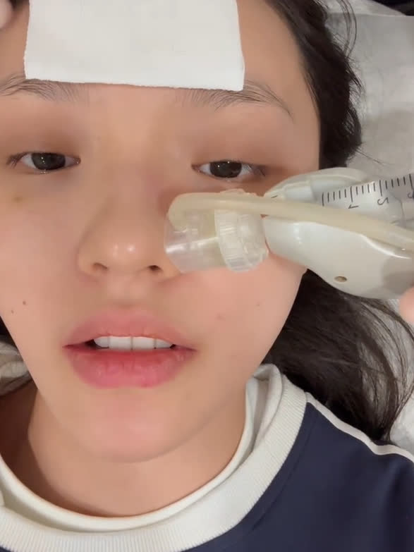 林允打水光针过程引热议,医美成明星保养常态?