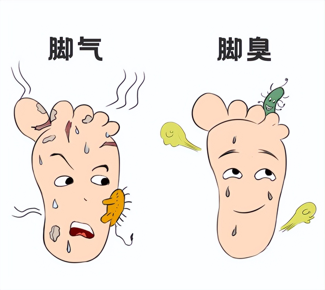 脚臭,脚癣,脚痒反复发作,治疗药物都有哪些?正确选择是关键