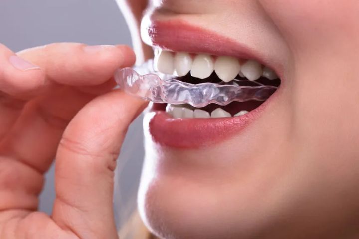隐形牙套牙齿矫正器透明牙套整牙器天地包龅牙防磨牙矫正保持神器