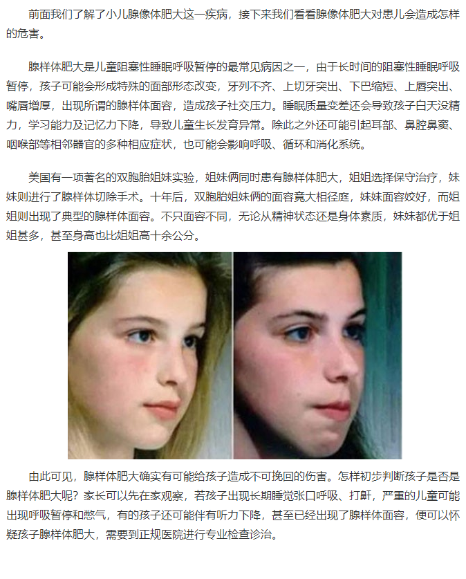 引起孩子面容异样的腺样体肥大到底是什么病(下)