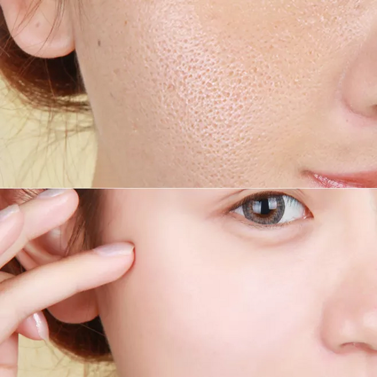 脸上油脂太多面毛孔粗大怎么办 #医美科普挑战赛#  收缩毛孔是许多人