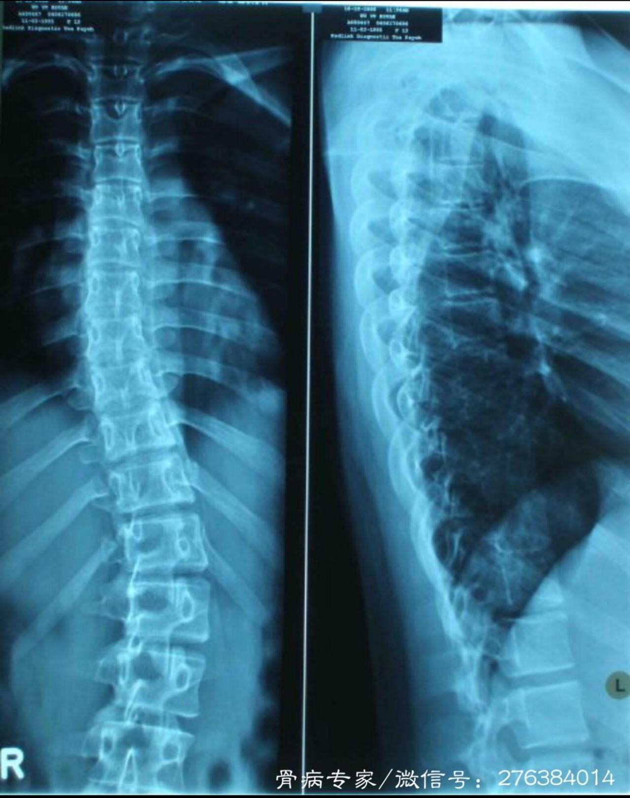 腰肌劳损?康复者亲身经历大曝光!7天轻松治愈!