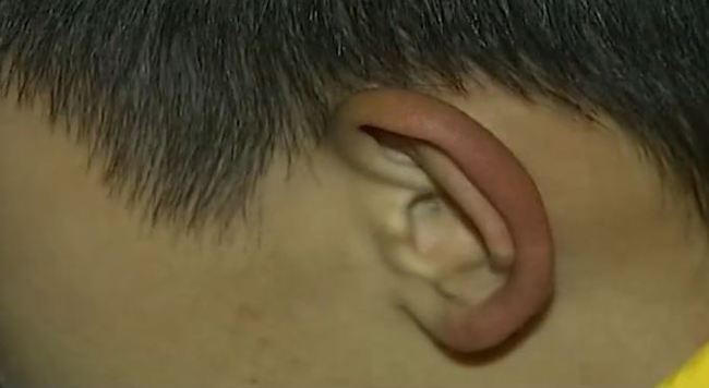 小男孩拥有特殊听力,能听见超声波,是神童还是有人故意炒作