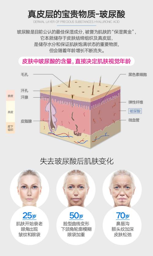 爱美丽嘉玺法令纹下垂能填充玻尿酸吗?