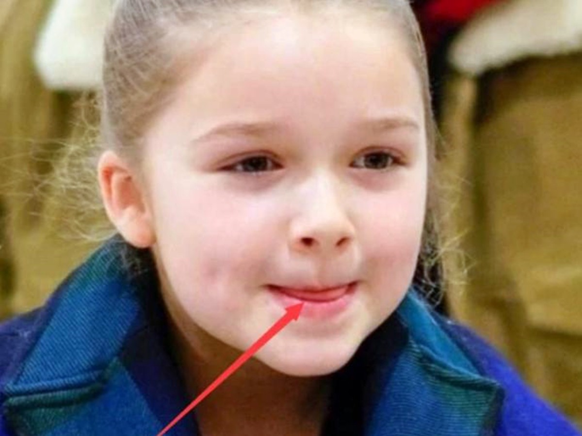 孩子嘴唇干裂,起皮还出血怎么办?医生教你正确护理,比喝水管用