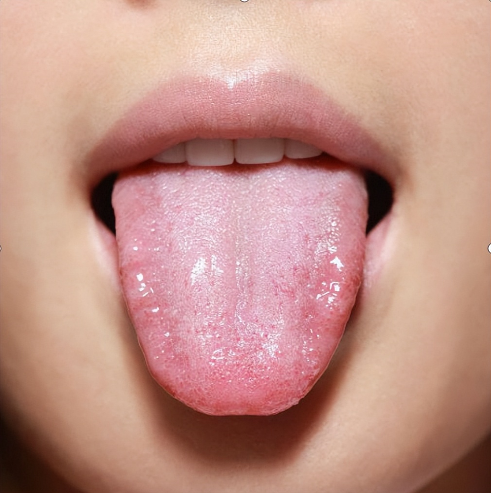 舌苔越黄,热邪越重,薄黄,干黄,腻黄,你是哪种黄舌头?
