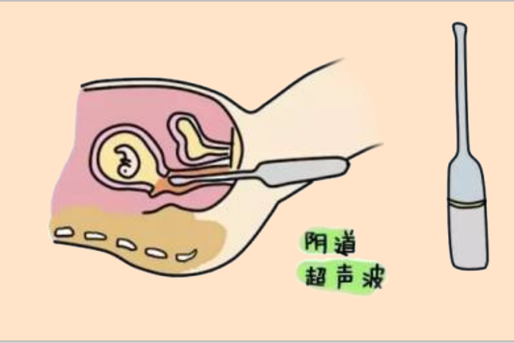 檢查時探頭會傷到身體嗎?別害羞,給你說清