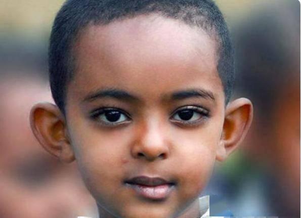 "穷人耳""富人耳"有无科学依据呢?耳朵如何保健?