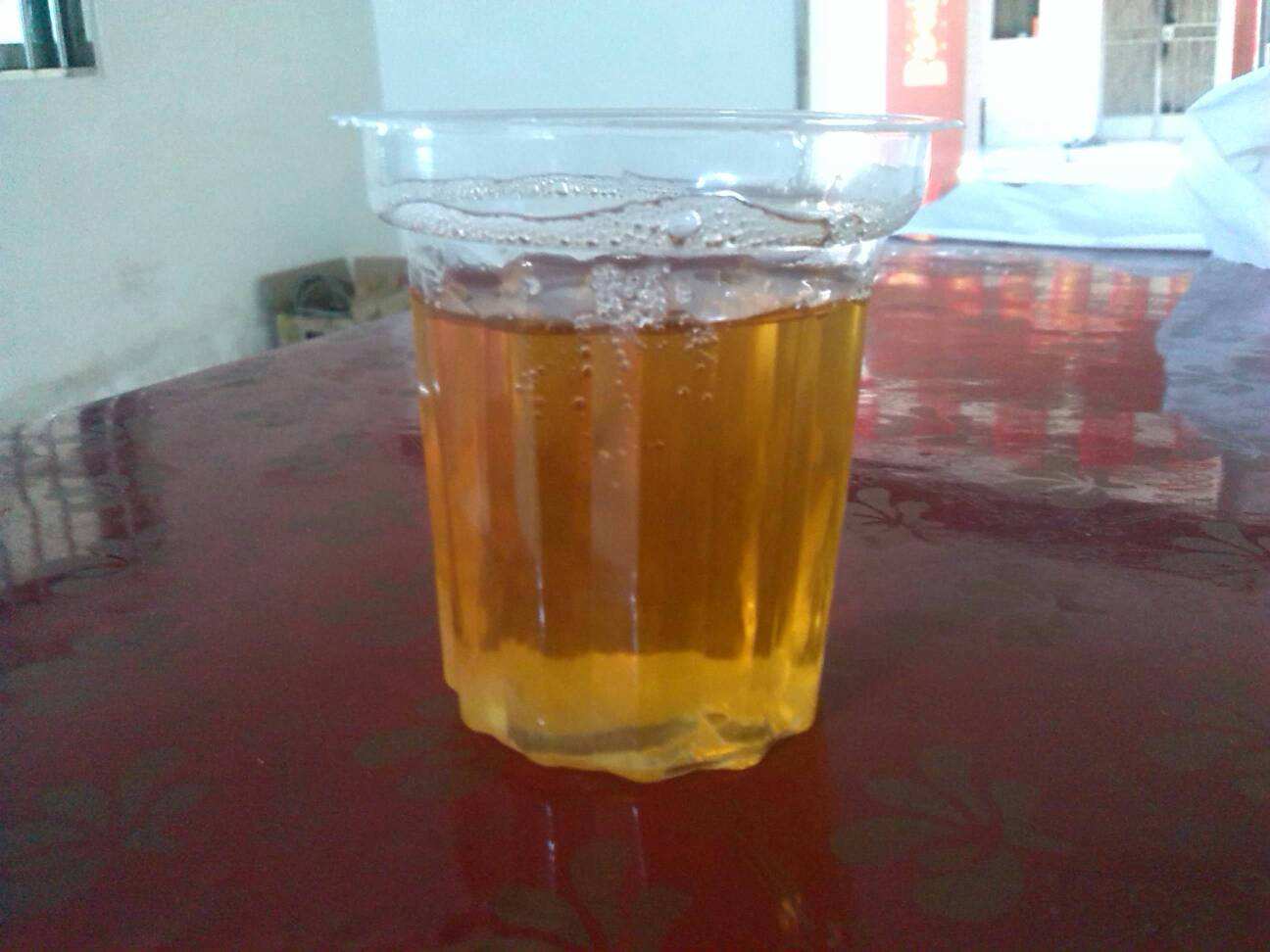 身体健康与否,如何判断?不用体检也能知道,教你看4个方面