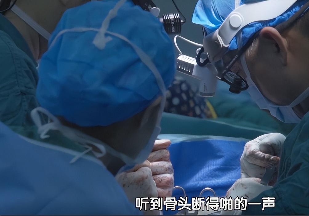 回顾"折叠人"李华:骨头被敲断4次,植入22颗钢钉,如今重获新生