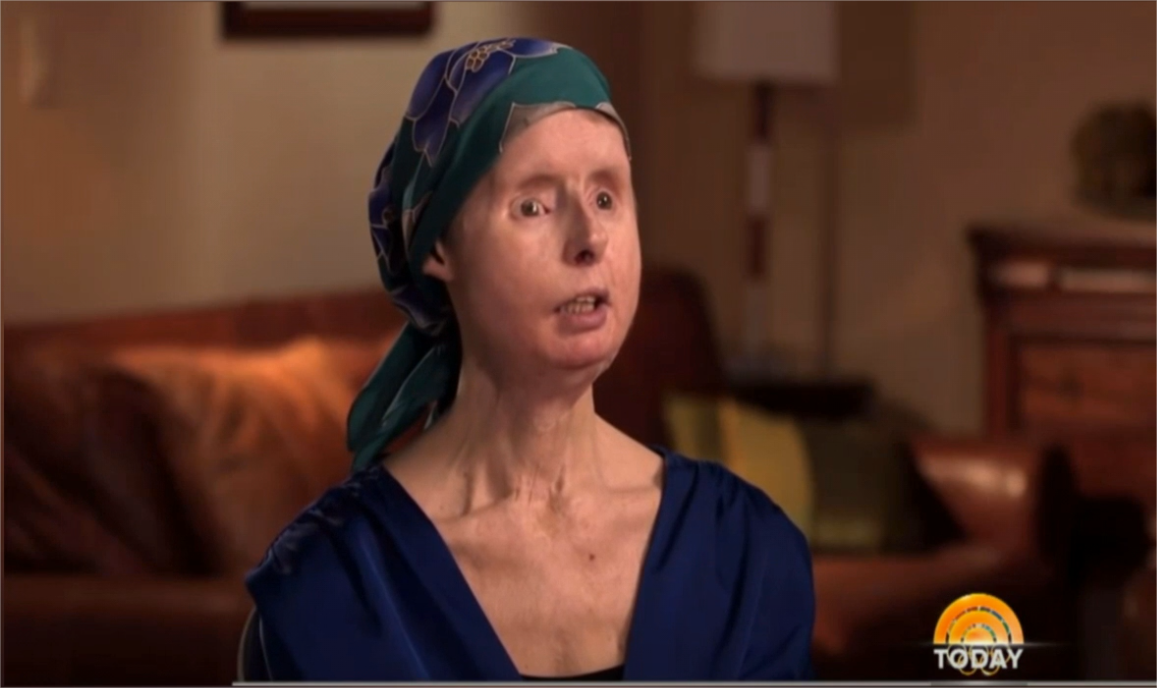 智商越高的动物,越不能当宠物养?黑猩猩特拉维斯惨案足以证明!