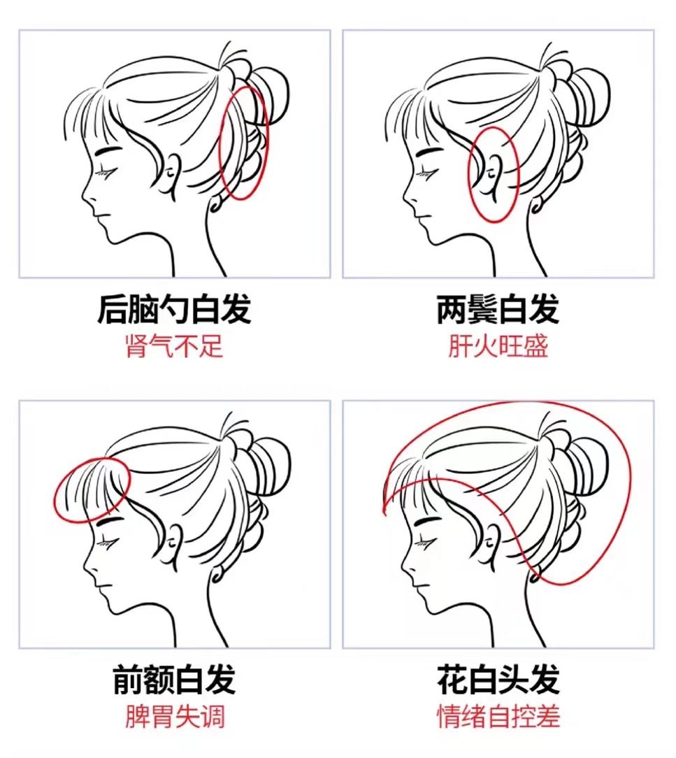 不同位置的白发预示健康状况?看完我悟了!