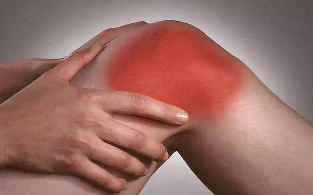 得了滑膜炎会引起什么症状?