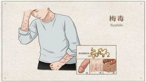 襄阳五医院男性健康：自测「性病」的一些方法