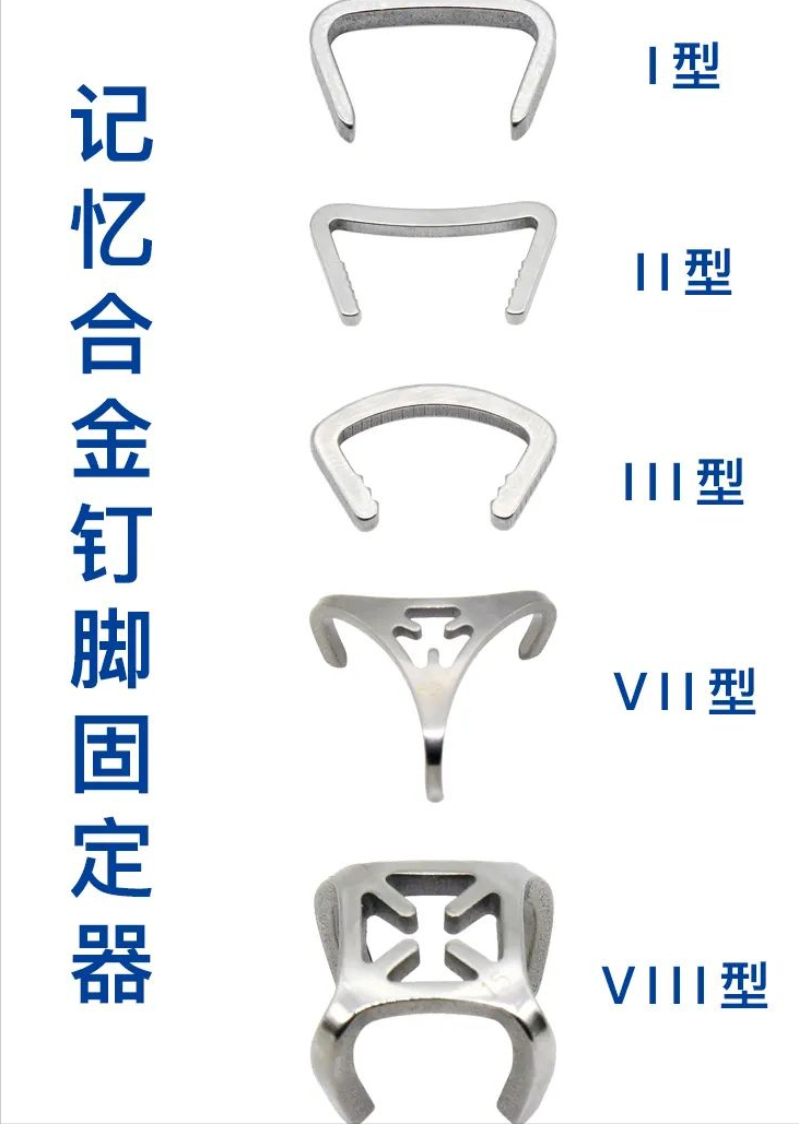 喜报兰州西脉记忆合金钉脚固定器享有drg豁免权