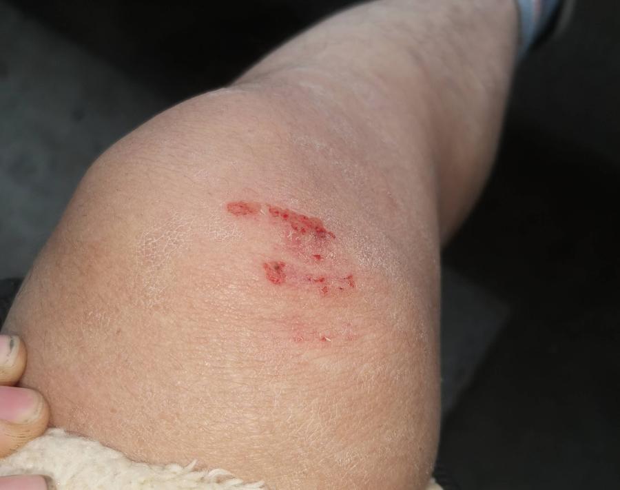 抚州一洒水车洒水致电动车主摔倒,官方回复了.