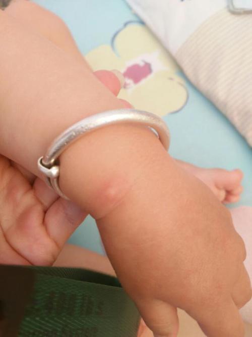 螨虫最怕的原来不是"暴晒"?教你一个新办法,比晒被子管用