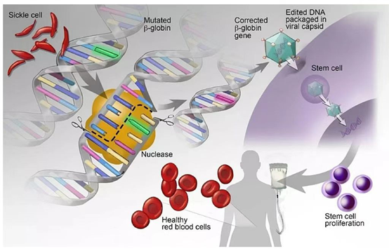 「對症創藥」造血幹細胞基因治療 β-地中海貧血的新希望