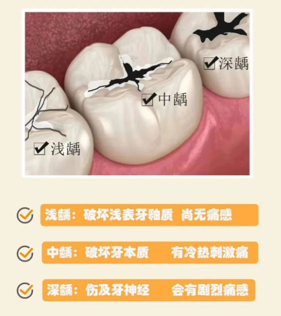 牙齿上有黑点是不是蛀牙?