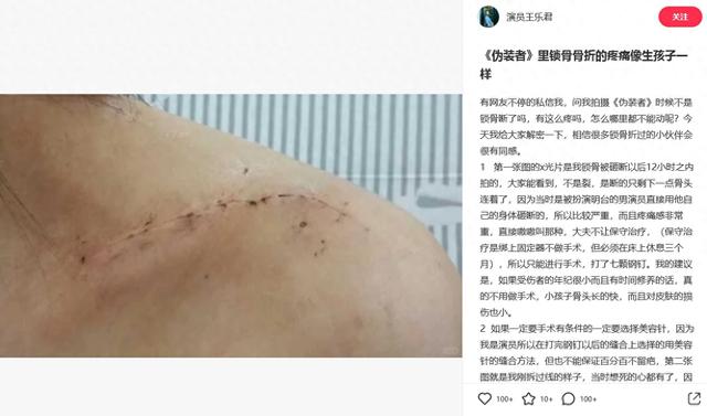 《偽裝者》女主王樂君控訴：被胡歌用身體砸斷鎖骨