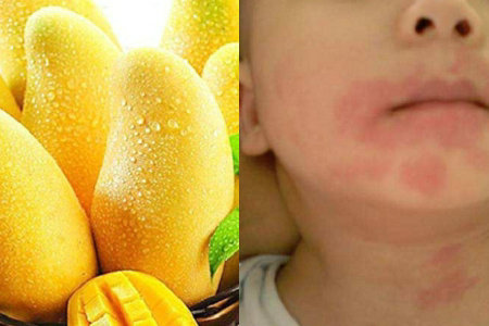 宝宝吃芒果过敏怎么办