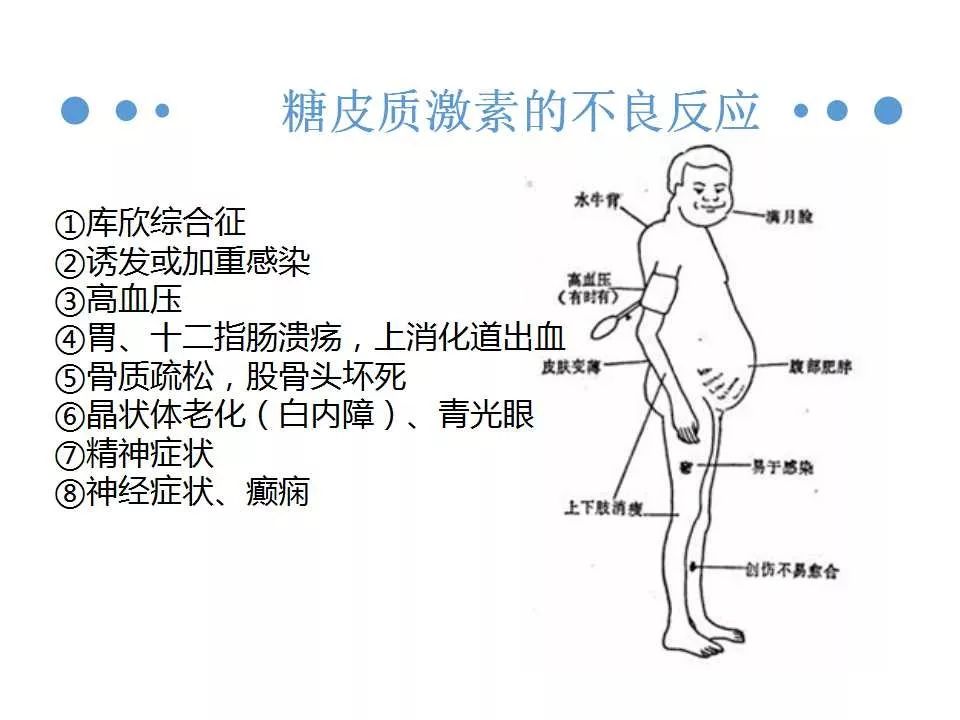 糖皮质激素副作用图片