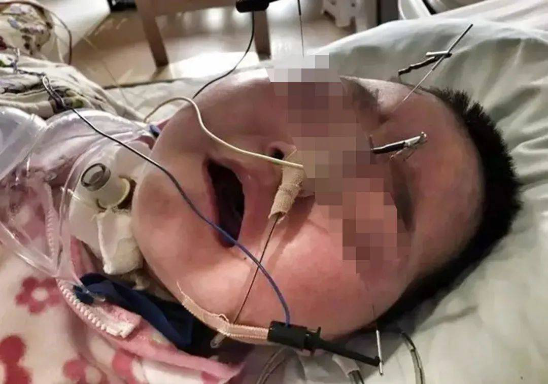 2015年那个遭烟头烫腿,经历四次心脏骤停的小辛怡,如今怎么样了