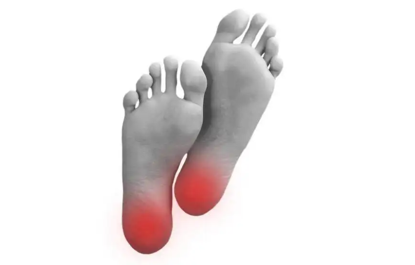 有一种痛,叫足底筋膜炎,哪几类人容易患上?