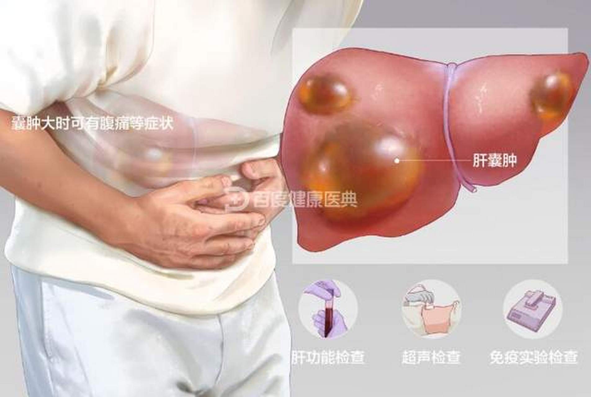 危险吗 肝囊肿一种常见的良性肝脏囊性疾病  多无明显症状,囊肿大时可