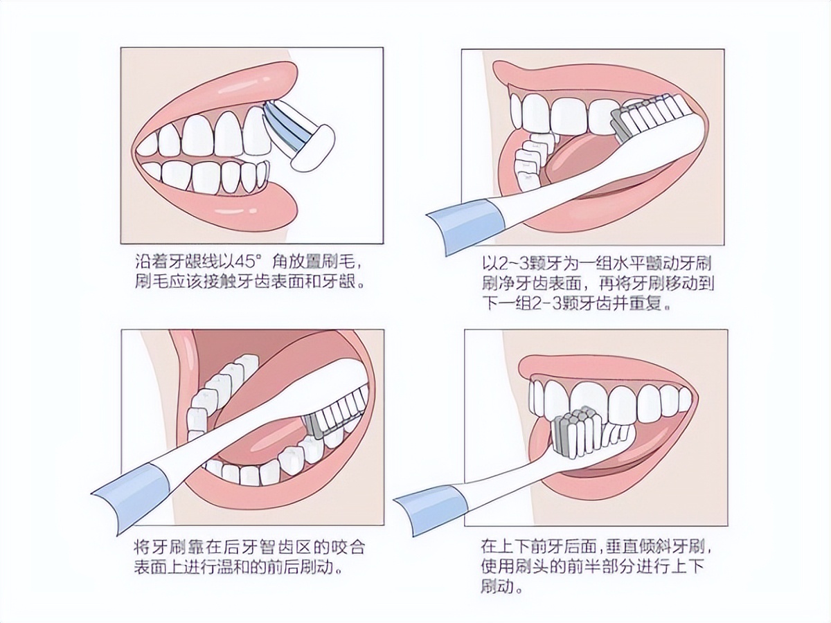 刷牙怎么刷才是正确的?打开刷牙的正确方式,从巴式刷牙法开始!