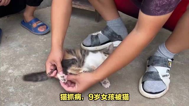 猫抓病怎么治疗图片