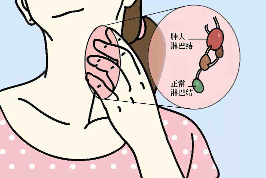 癌细胞发生转移,扩散,身体会有何表现?医生:这5种症状较常见