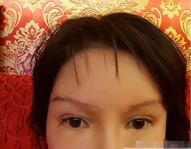 天价整容200次的"红粉宝宝",面目扭曲,网友:对得起父母吗