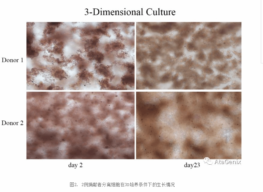 三維細胞培養技術突破之卵巢癌原代細胞