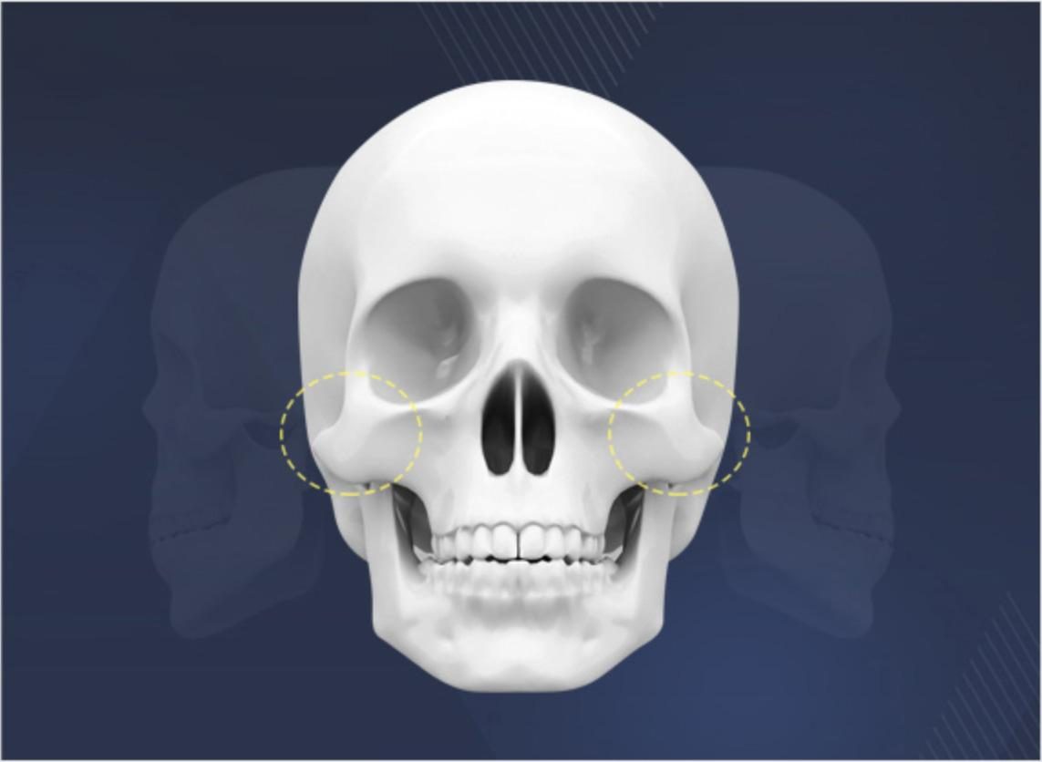 脸骨 baijiahao.baidu.com