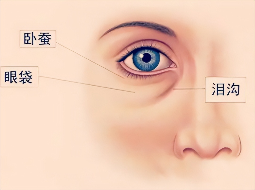 来了来了~脂肪填充泪沟有硬块怎么办?脂肪填充后的硬块咋处理?