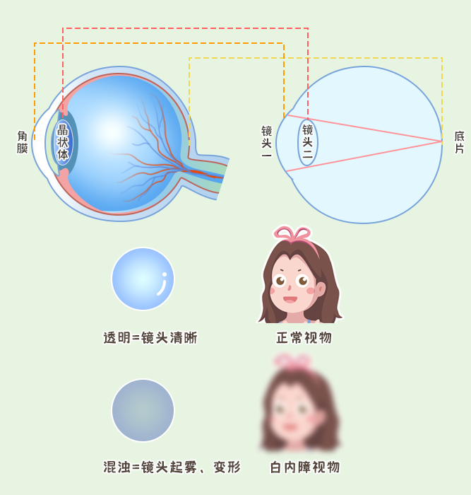 复视看东西的样子图片图片