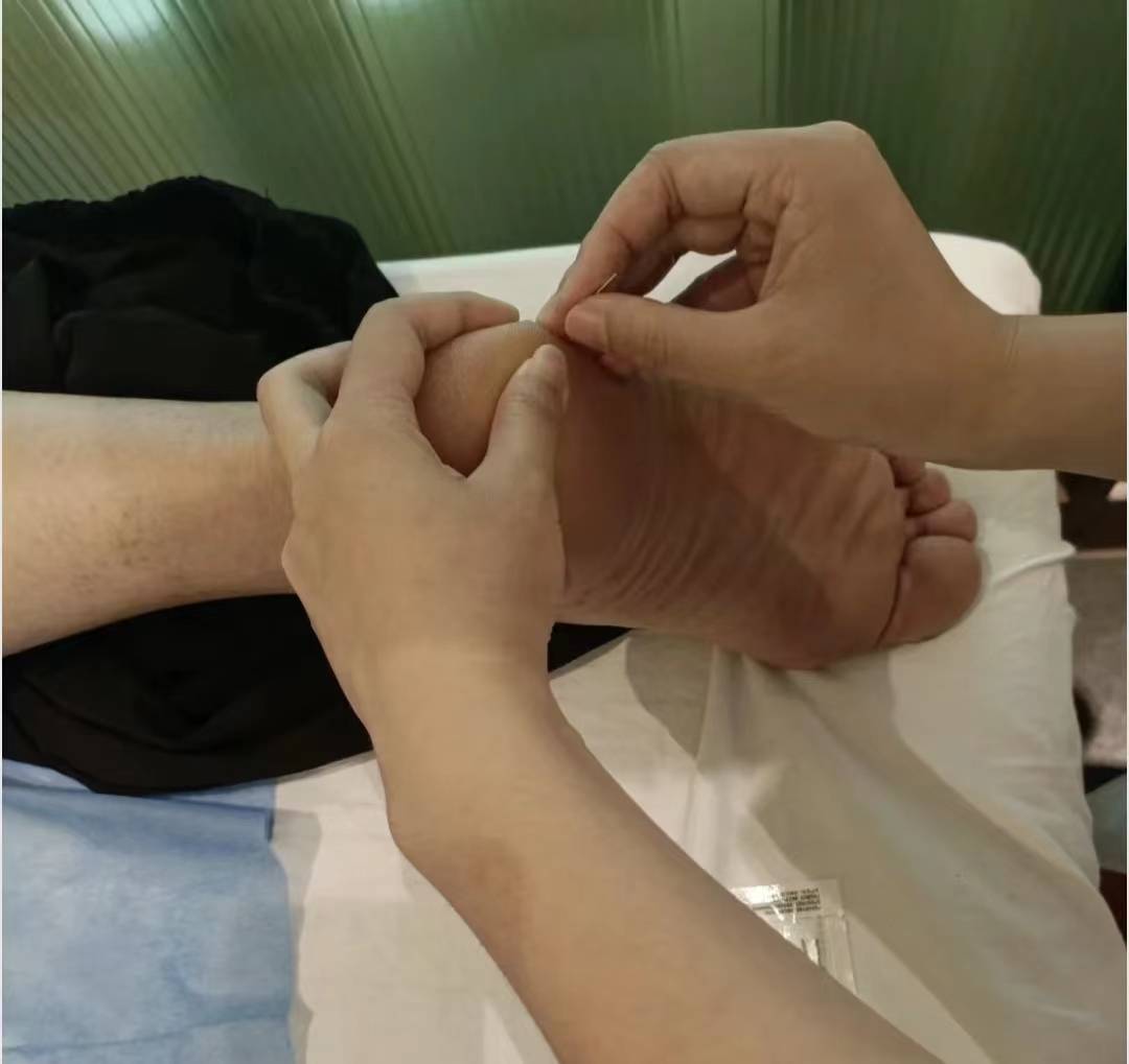 不小心患上足底筋膜炎!过来人教你轻松摆脱!