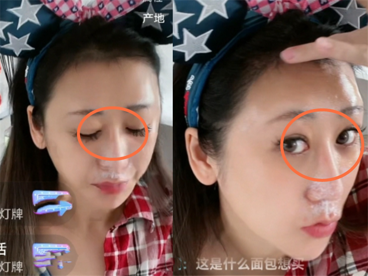 蒋丽莎带伤直播疑被家暴?下巴淤青,鼻红肿,曾当众嫌陈浩民无能