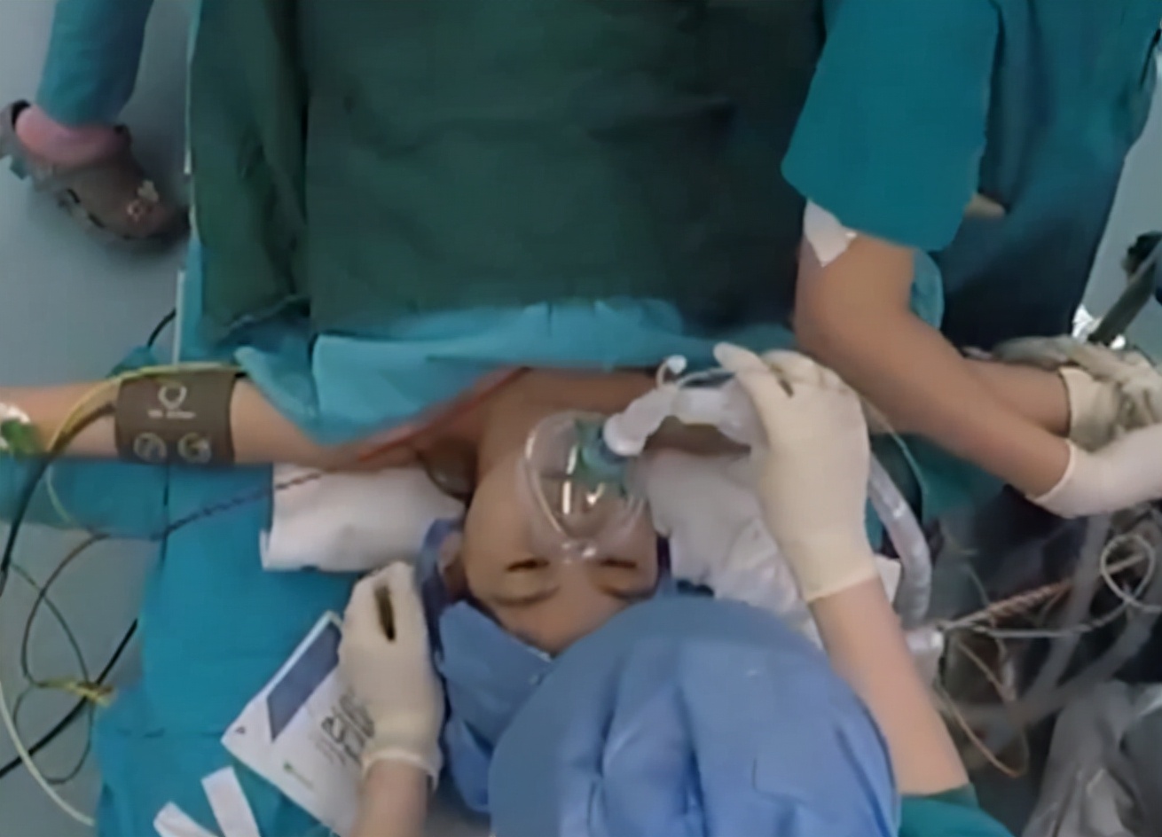 北京10岁女童体内长肿瘤,腹腔内粘连动脉长达9年,医生深受震撼