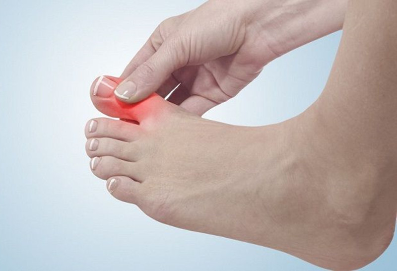 大脚趾疼痛,拇囊炎和关节炎有什么区别,如何治疗?