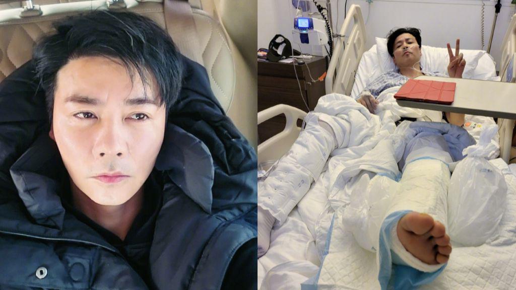 男星张晋拍戏受伤送医急救,脚部骨折装鼻导管病况曝光