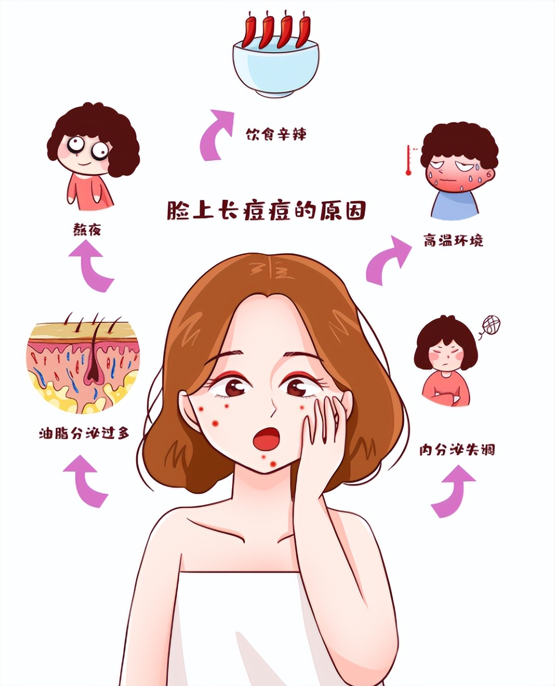 痘痘,闭口为什么总找上你?真相原来如此简单