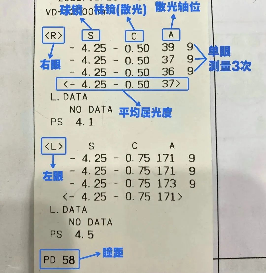 10秒看懂电脑验光单,找准这几个参数即可!