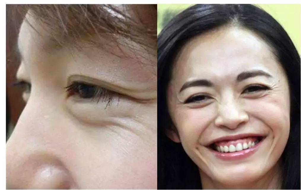 脸上有这5个特征的女人,容易显老,才20岁,看着却像30多岁