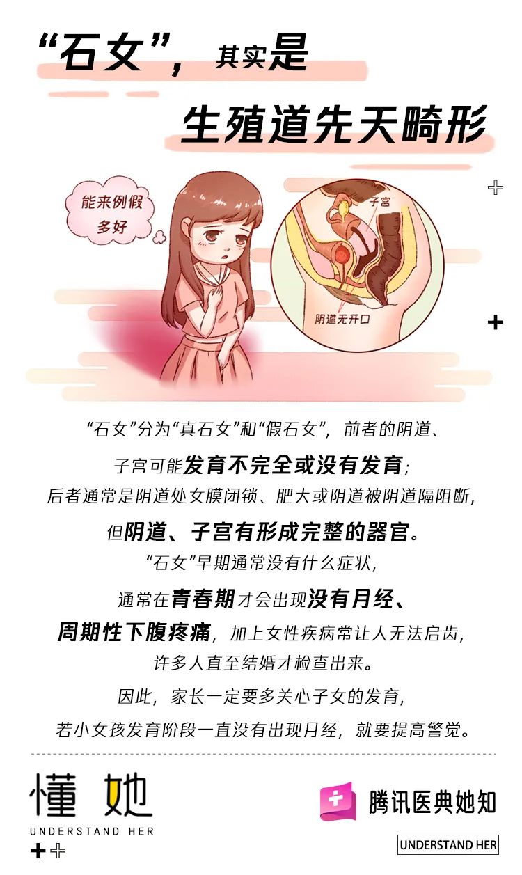 什么是石女图片图片