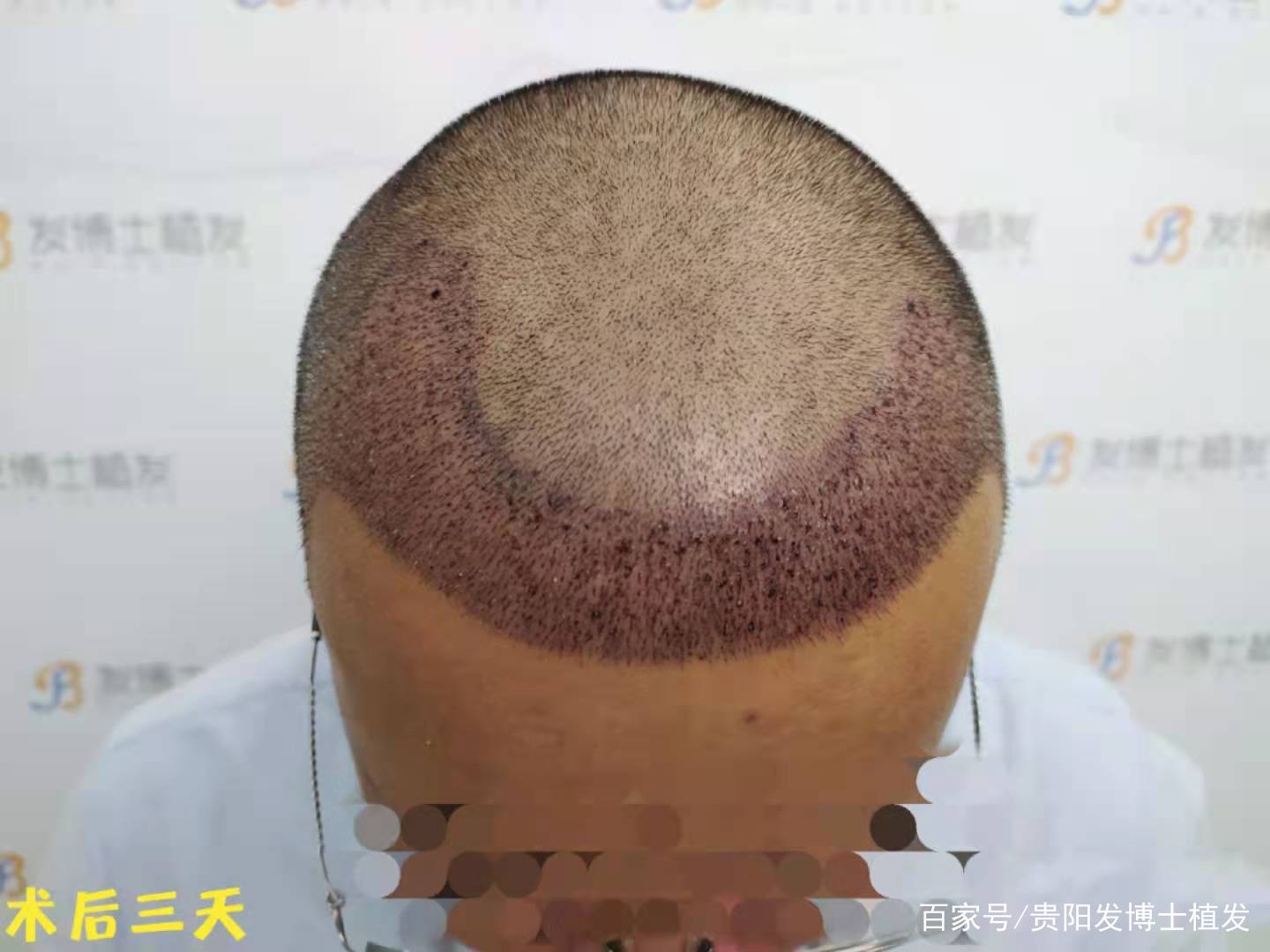 相亲群体植发(相亲发型重要吗)